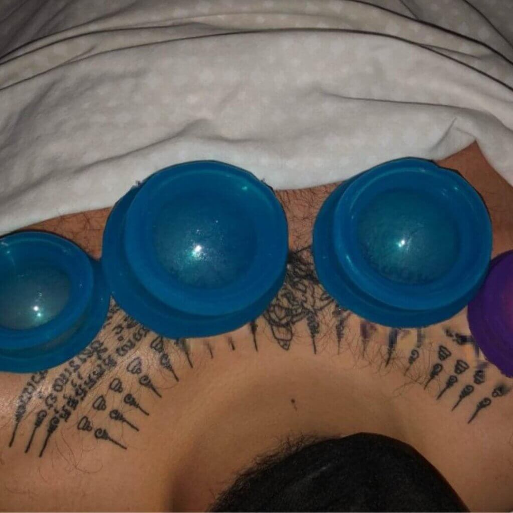 Photo of man with tattoos getting a cupping massage